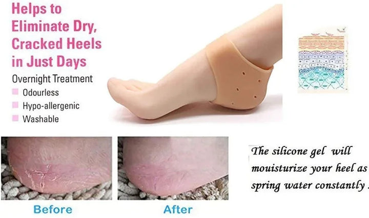 Half Heel Socks Anti Crack Silicon Gel Heel And Foot Protector